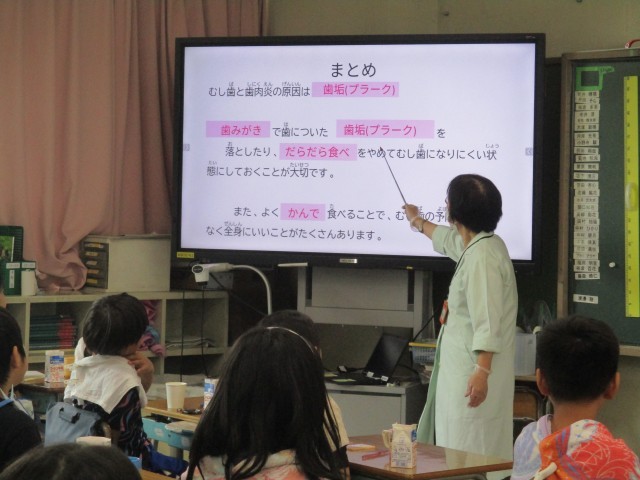 歯の汚れを染め出しする様子